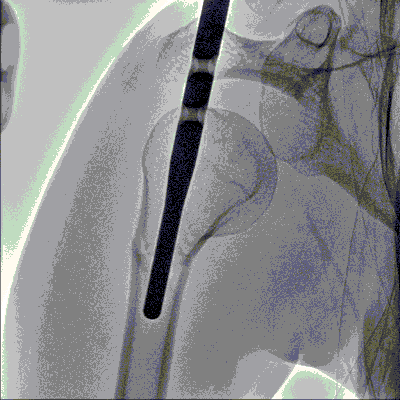 c arm x ray.bmp